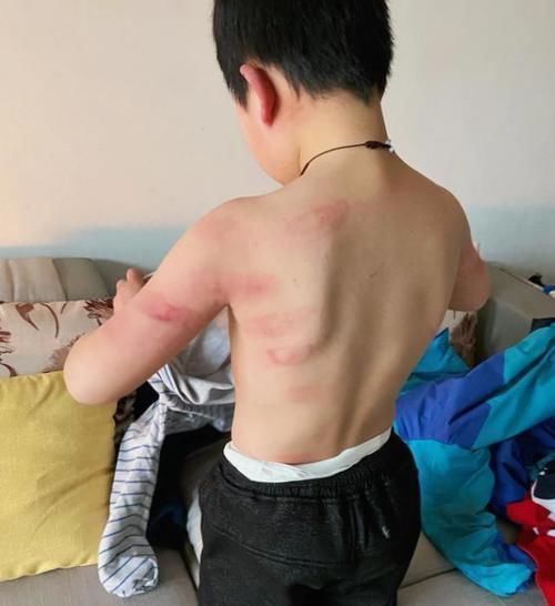 惩罚|孩子犯了错,母亲一顿狂揍,家人怪她下手太重,谁对谁错?