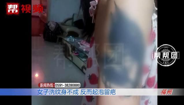 皮肤起泡化脓留疤,医生提醒,做这事得谨慎!