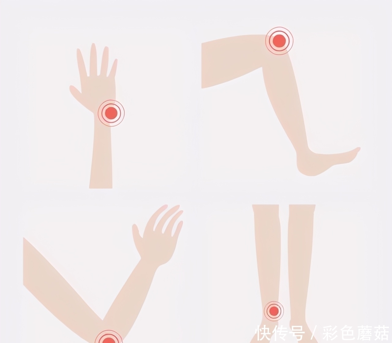 黏稠|血液粘稠的人，通常有5个表现，占2个以上，血管可能堵塞了