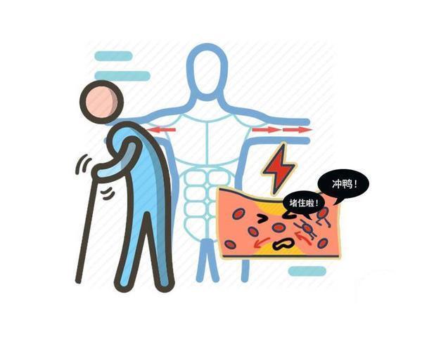 食物|天然“溶栓剂”找到了!45岁过后,多吃3种食物,血栓可能会远离