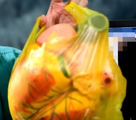 心脏中心|16岁初中生突然不能活动,医生从他体内抽出红色液体