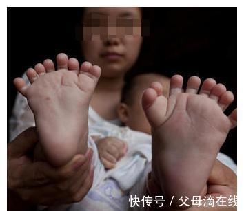 妈妈|出生3个月大男孩有31根指头，4个手掌像莲花，母亲崩溃不已