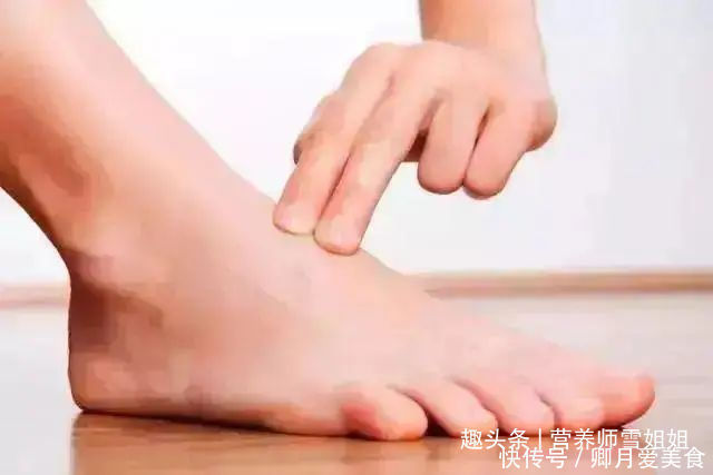 女子|43岁女子，头晕眼发黑，查出脑梗，只因一种“零嘴”吃太多