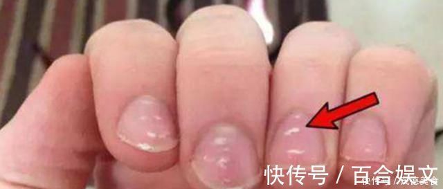 补锌|补锌广告铺天盖地,宝宝要不要补锌,看看这个地方就知道