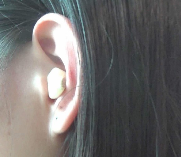 大蒜放耳朵里效果太好了,关于大蒜放耳朵里的