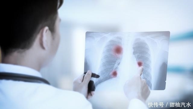 hpv|体检不做五个检查,得了癌症却不知道,五个部位最好多久体检一次