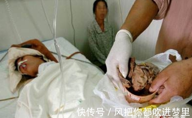 避孕环|40岁女子到医院取节育环,看到患者医生报了警