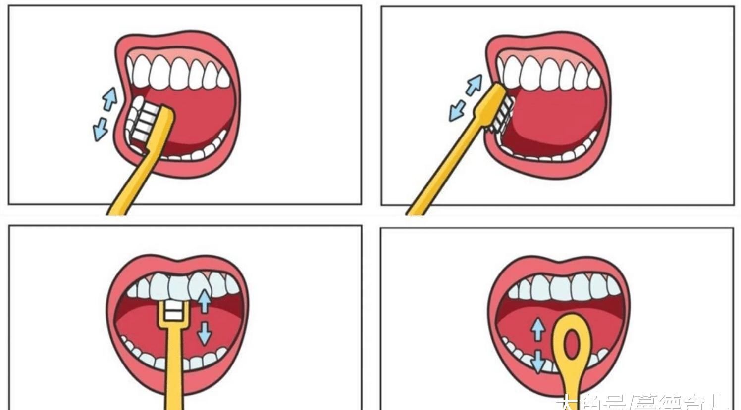 龋齿|3岁男童不吃糖，却长了一口黑牙，牙科医生说都怪父母瞎胡闹