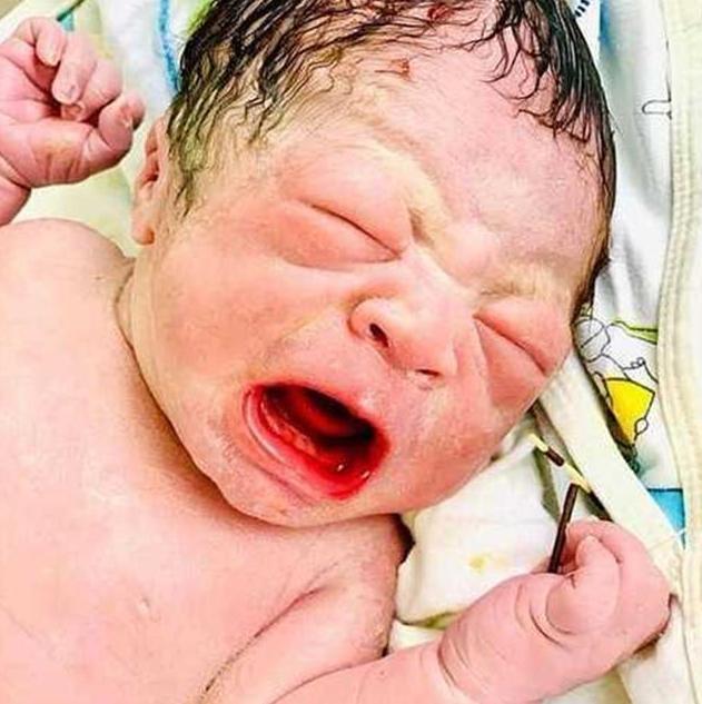 避孕套|34岁女子“上环”后仍怀孕,10个月后,宝宝握着“避孕环”出生