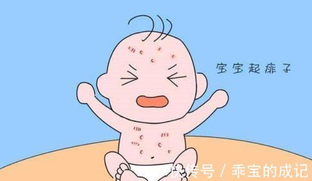 晒伤|夏季家长如何给宝宝护肤,正确护理可以让宝宝远离皮肤问题