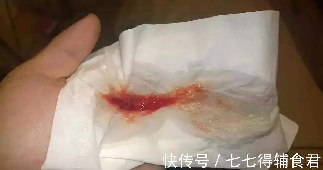 鼻腔|宝宝鼻涕不断怎么办?比打针吃药更有效的方法是这个!