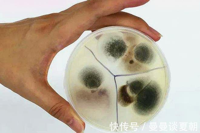 代謝物|尿液發黃是上火不一定，也可能是4種身體信號，希望你沒忽視