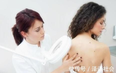 红痣|身上突然长了很多小红痣，是什么原因？其中1个需警惕，不可忽视