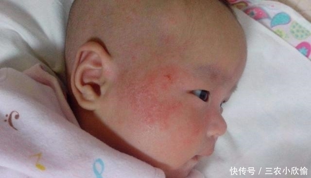 宝宝|新生儿出现这3种情况时，要立刻带宝宝去医院，不要往后拖