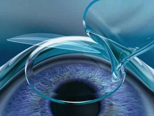 激光治疗|十年前用激光治近视的人，现在眼睛状态如何？结果令人唏嘘