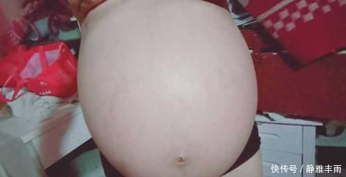 畸形|孕期人机不离身,准妈妈对辐射不以为然,胚胎被诊断畸形