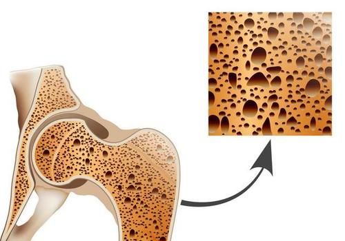补钙|年纪越大，膝盖越疼吗？55岁后尽量少吃这“一物”，不妨了解下