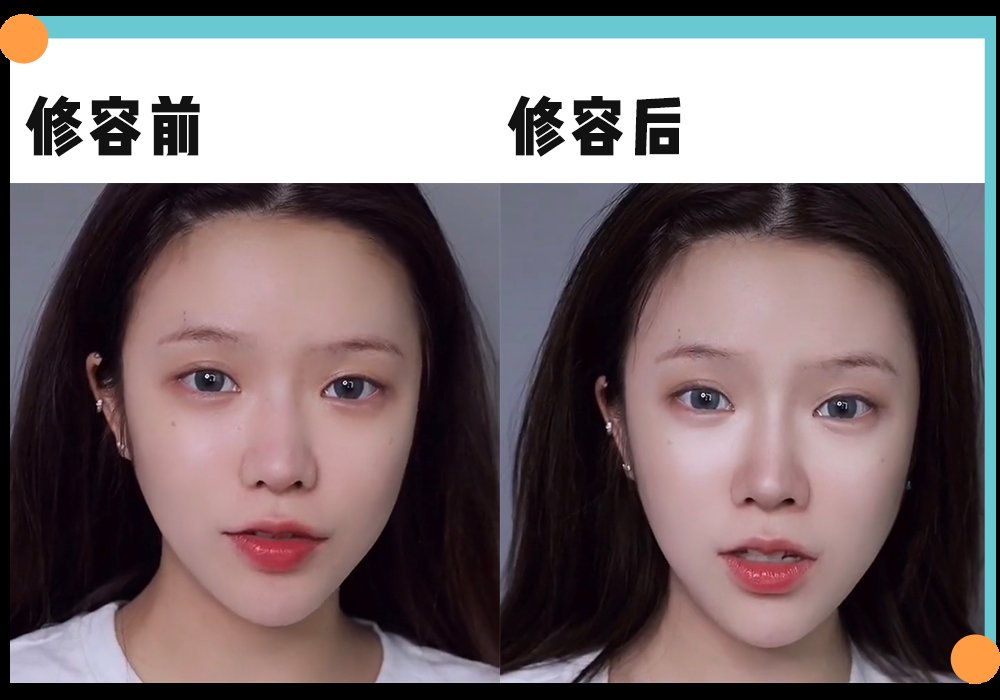 周也|面部折叠度是什么鬼？新一波的审美焦虑又来了？