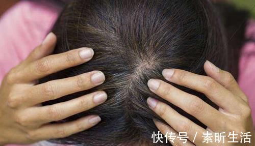 黑发|白头发拔1根长10根？3个“狠角色”，白发、脱发全拿下，显年轻