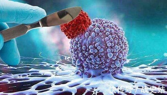 危险期|晚期癌症病人进入危险期的5大症状,去世前的8个征兆