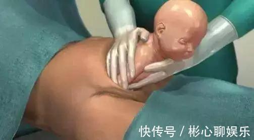手术|剖腹产到底要挨几刀没你想的那么简单,只有经历过的人才懂