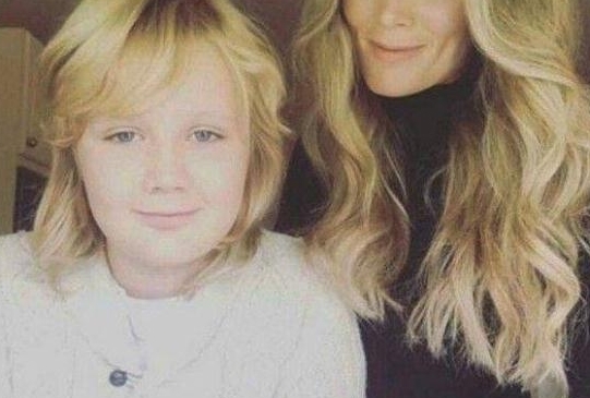 英国女子去美容院做了个酒窝，从那以后却不敢轻易笑