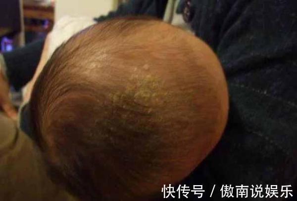 医生|3个月宝宝半夜高烧不退,医生检查完孩子头部,气的当场发飙!