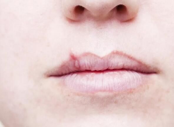 健康|身体健康不健康，通过嘴唇颜色可以判断
