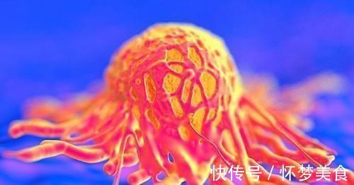 癌症患者|癌症自愈情况的出现,或许与4个方面也相关,不妨了解下