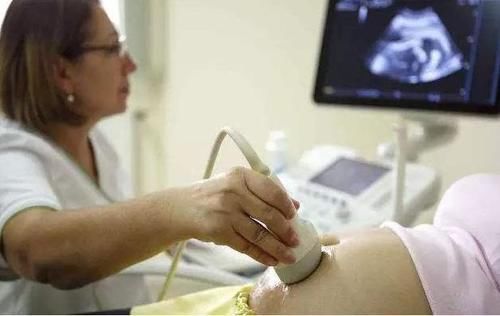 子宫|为什么产检时，医生会问“头胎还是二胎”？这几点不同你该了解