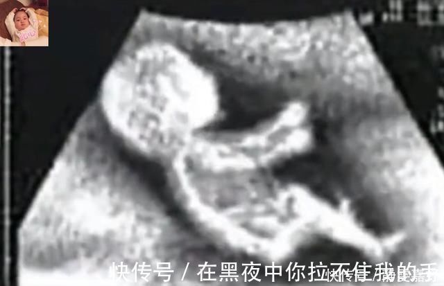 中期孕|除了睡觉,胎儿如何每天在肚子里都干啥宝宝小日子开心到飞起