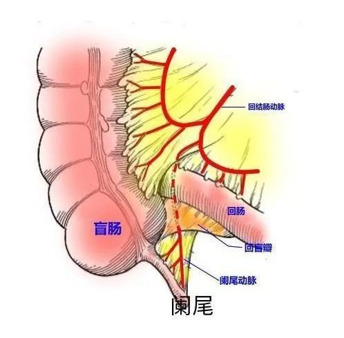 腹膜炎|【科普时间】小儿阑尾炎