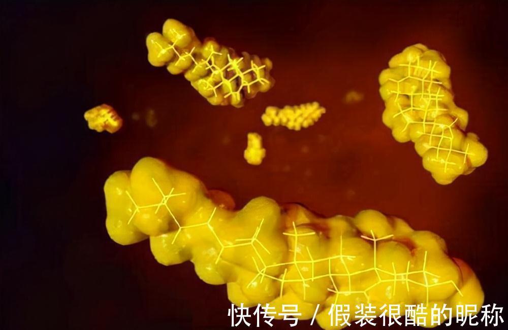 脂肪含量|血脂高不能喝牛奶?提醒:若甘油三酯超标,这“2物”也尽早远离