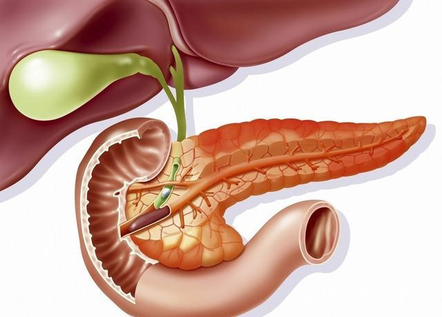 急性呼吸窘迫综合征|42岁男子腹痛,情况让医生担忧,如果你有类似腹痛,一定别耽误