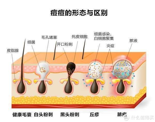 清洁 反复长痘必看！从祛痘到抗老，保姆级护肤经验分享！