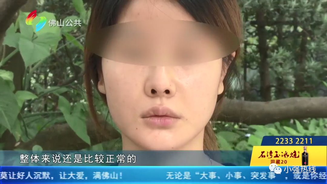 鼻孔 隆鼻后不满意，女子再做鼻子修复手术！这次仍不满意？