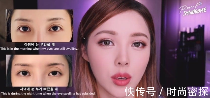 双眼皮 美妆教主Pony大方坦承整形两次!术后跟粉丝分享“术前VS术后”!