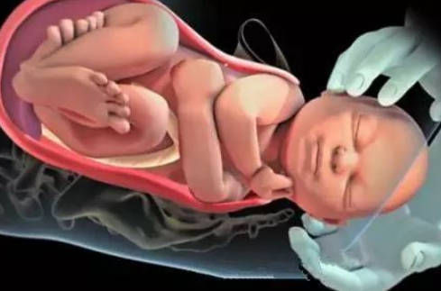 小子宫|产房分娩的过程是啥?实拍图还原顺产过程,看完明白为母则刚