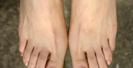肾脏|“肾”好不好看脚,脚上如果没有以下4种情况,说明你的肾很健康