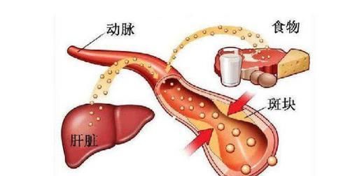  高血脂的“对头”被发现了，早晚都吃点，帮你疏通血管降血脂！