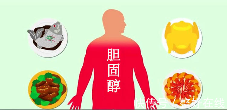 高女士|55岁女士高血脂6.8降到1.8,每天只做3件事,专家:方法值得学习