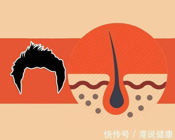 这件事|每6个人就有1人脱发?脱发这件事,很多国人都陷入一个严重误区