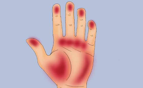 指甲|肝不好,双手会有提示,3个异常表现,伸出双手看看你有没有