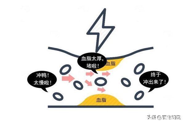 血管内膜|心血管科医生:这4种家常菜,或是血栓的“帮凶”,劝你管住嘴
