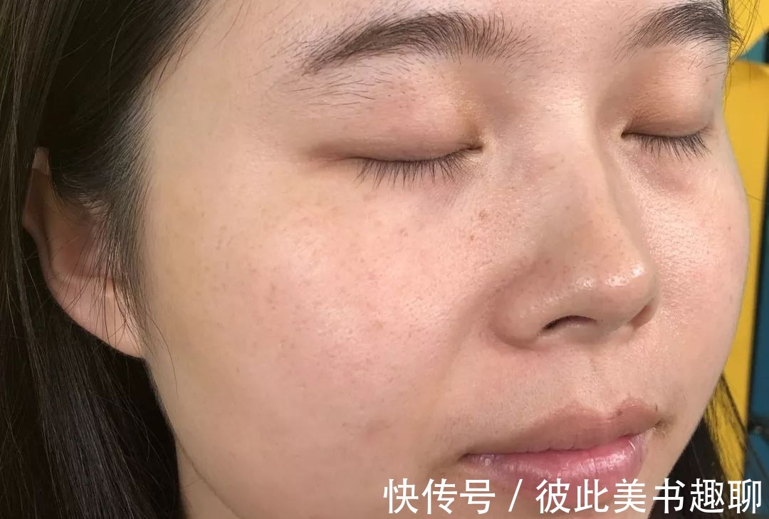 护肤|为什么脸部皮肤总会出现问题?你想要的护肤秘籍,这里全都有