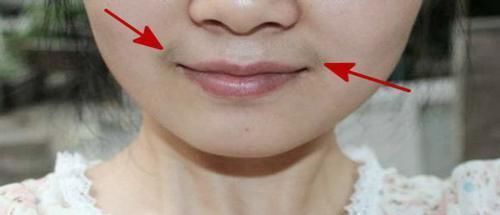 胡须|女性子宫好不好,看脸上有没有以下4种表现