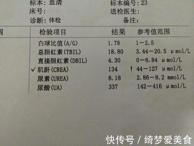 调理|男子仅用90天,尿酸从762降到337,他的经验或许对你有用