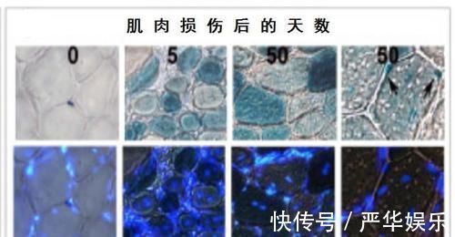 损伤|为什么撸铁这类锻炼才能有效增肌?增肌的原理是什么?