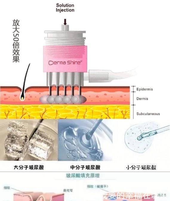 分子量 玻尿酸的前生今世！护肤、口服、医美，竟然连TT里面都有添加！