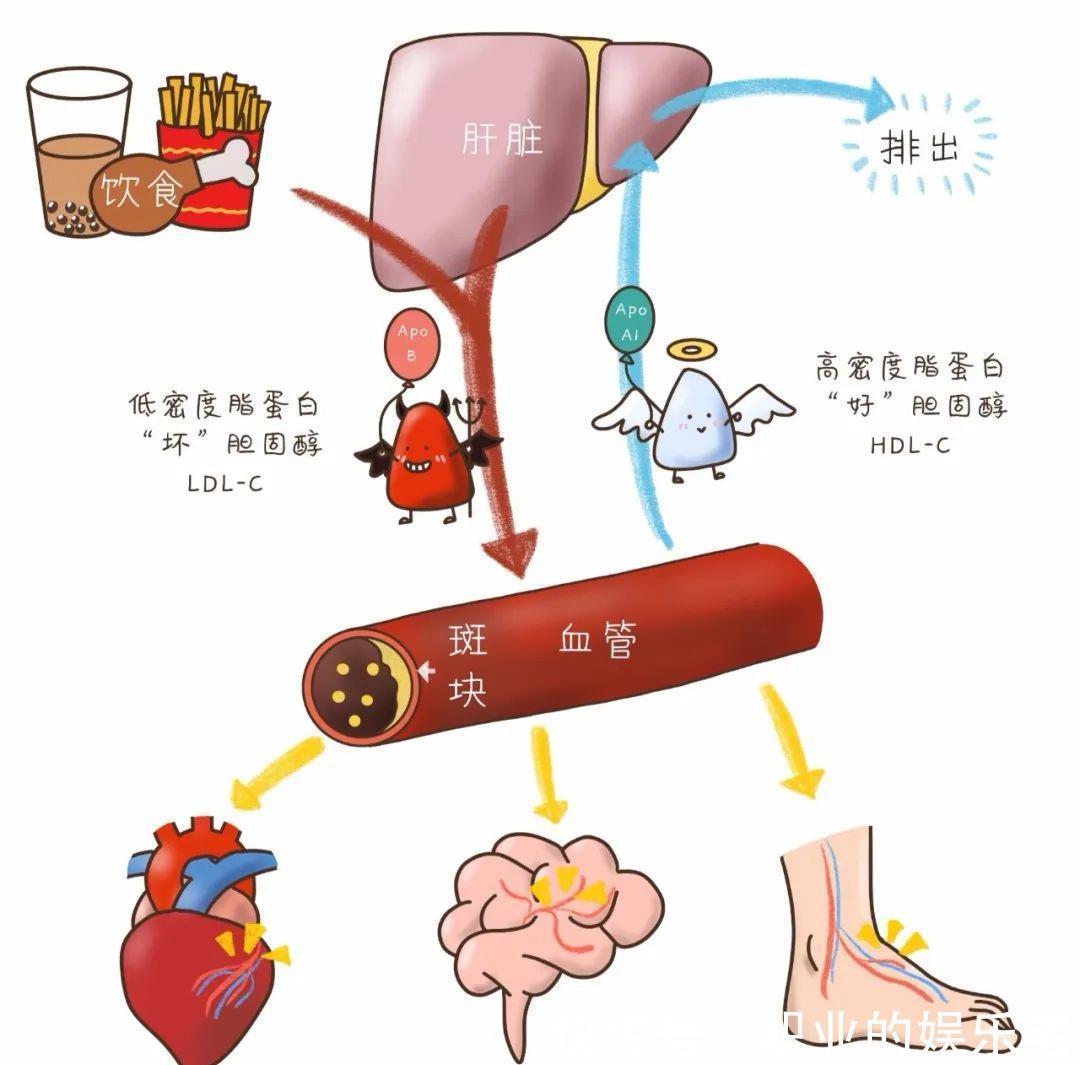 他汀药物的4个常见副作用，医师提醒：6种方法可降低风险